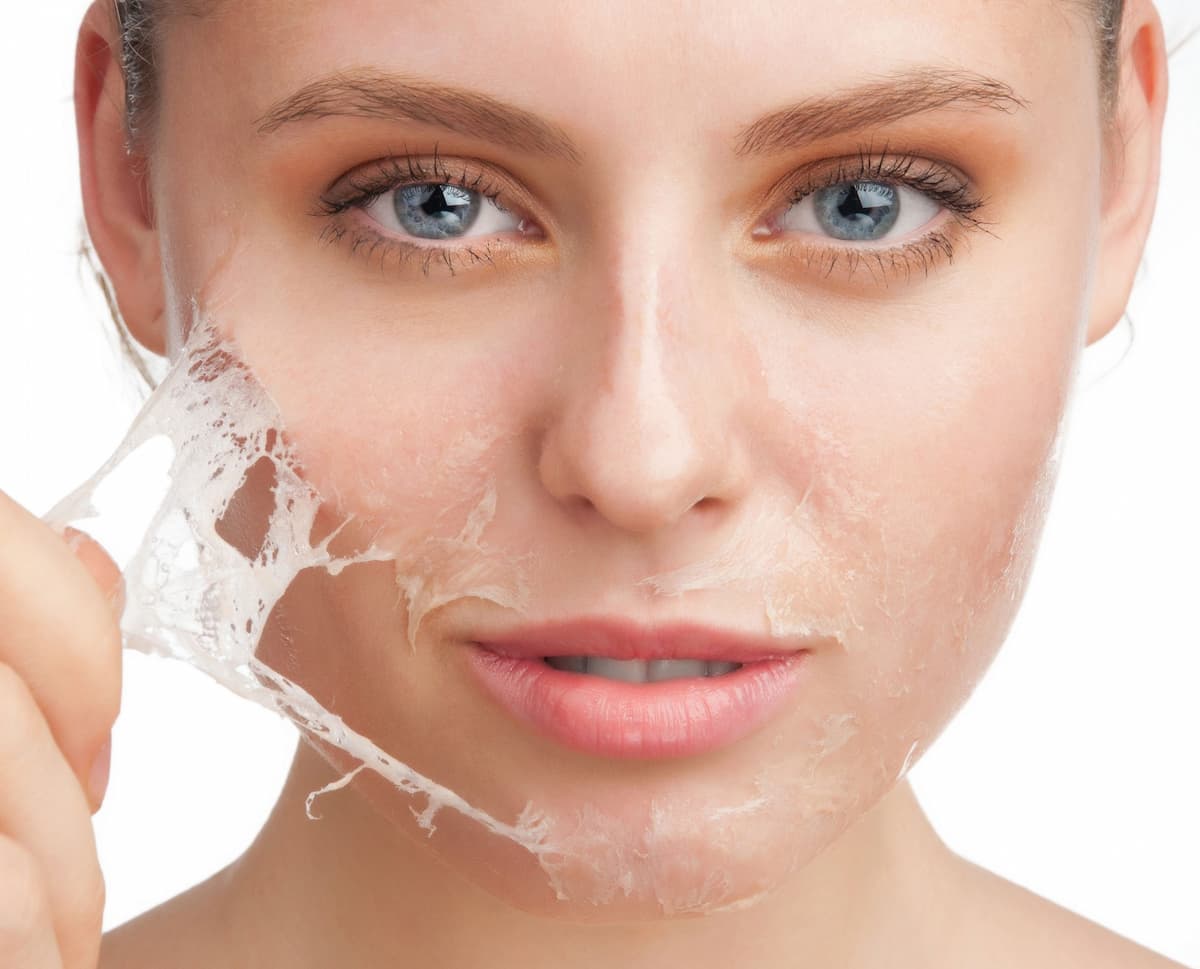 peeling facial