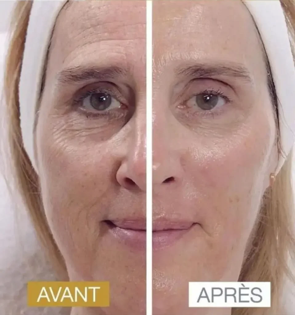 esther rosello tratamiento age reverse