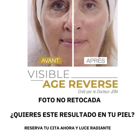 tratamiento antiedad con Visible Age Reverse