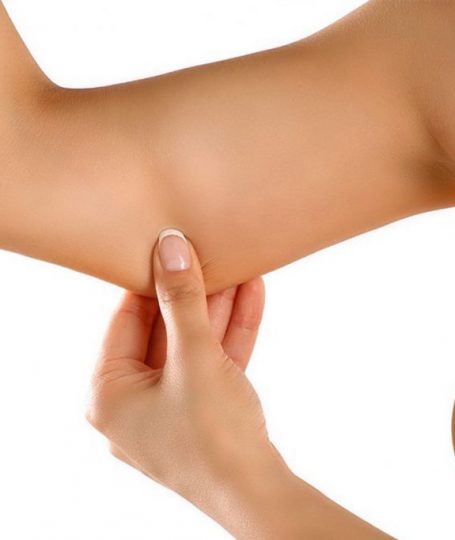 como eliminar celulitis de los brazos